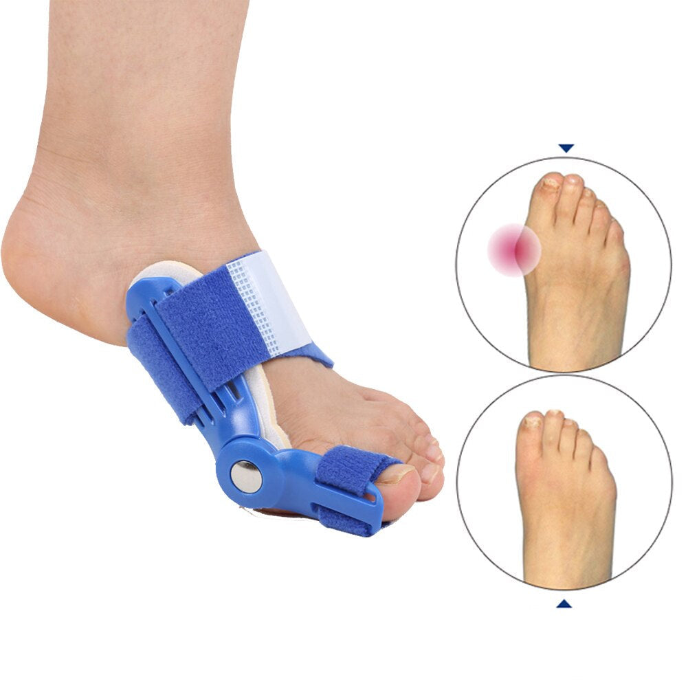 Corrigerende Spalk voor Hallux Valgus (1 Paar) - BunionFix