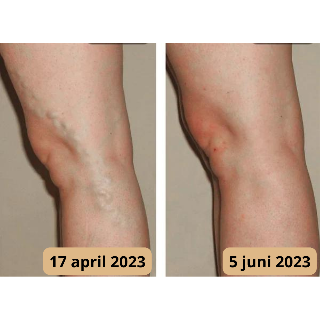 Voetmassage Mat - AcupressureFlow