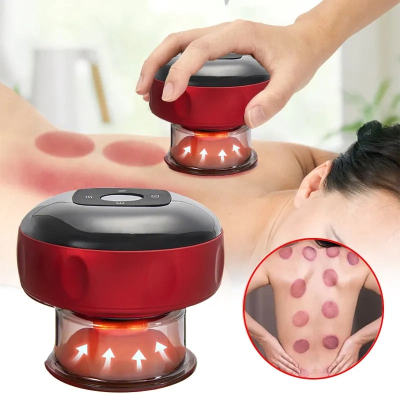 Cuppingtherapie Massager - ThermaCupp