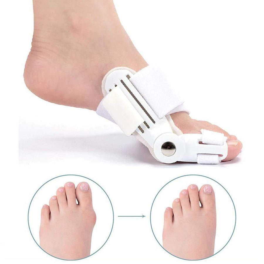 Corrigerende Spalk voor Hallux Valgus (1 Paar) - BunionFix